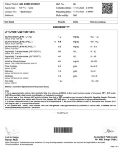 Liver Function Test report sample